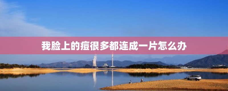 我脸上的痘很多都连成一片怎么办 我脸上的痘很多都连成一片怎么办